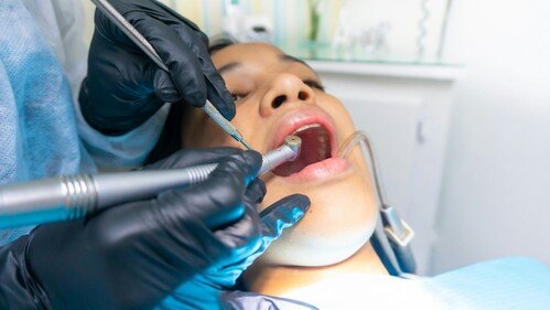 Oral Health During Cancer Treatment: Managing Dry Mouth for Better Quality of Life